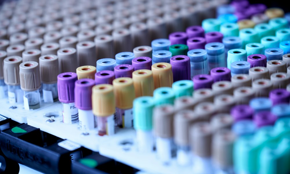 Metenolonacetat: Mythen und Fakten